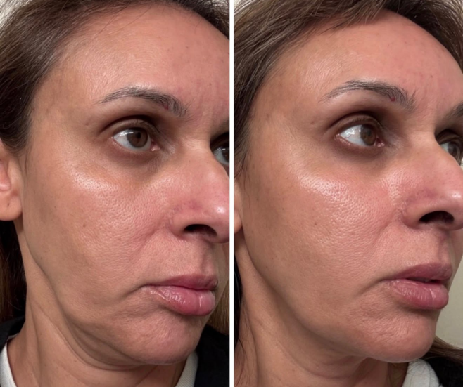 Before and after result from the Beauty Guru reference gallery, example 6