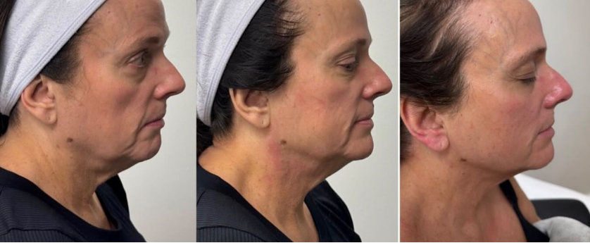 Before and after result from the Beauty Guru reference gallery, example 5
