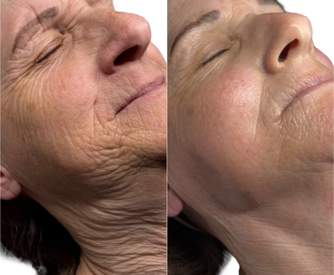 Before and after result from the Beauty Guru reference gallery, example 2